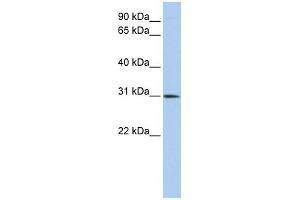 WB Suggested Anti-DLX1 Antibody Titration:  0. (DLX1 antibody  (C-Term))