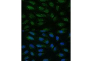 Immunofluorescence analysis of U-2 OS cells using HIBCH antibody (ABIN7265331) at dilution of 1:100. (HIBCH antibody  (AA 33-330))