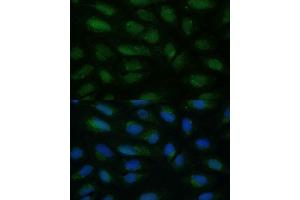 Immunofluorescence analysis of U-2 OS cells using HIBCH antibody (ABIN7265331) at dilution of 1:100. (HIBCH antibody  (AA 33-330))