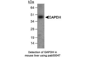 Image no. 1 for anti-Glyceraldehyde-3-Phosphate Dehydrogenase (GAPDH) antibody (ABIN363356) (GAPDH antibody)