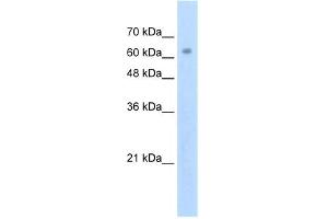 WB Suggested Anti-ZNF274 Antibody Titration: 2. (ZNF274 antibody  (N-Term))