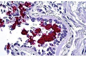 Human Lung: Formalin-Fixed, Paraffin-Embedded (FFPE) (MUC5AC antibody)