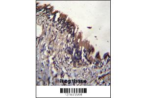 NUDT9 Antibody immunohistochemistry analysis in formalin fixed and paraffin embedded human lung tissue followed by peroxidase conjugation of the secondary antibody and DAB staining. (NUDT9 antibody  (C-Term))