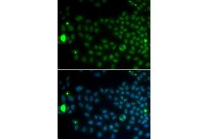 Immunofluorescence analysis of MCF7 cell using SPDYA antibody. (SPDYA antibody  (AA 1-313))