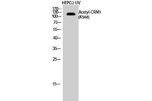 Western Blotting (WB) image for anti-Exportin 1 (XPO1) (acLys568) antibody (ABIN3178876) (XPO1 antibody  (acLys568))