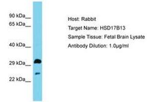 Image no. 1 for anti-Hydroxysteroid (17-Beta) Dehydrogenase 13 (HSD17B13) (AA 91-140) antibody (ABIN6750566)