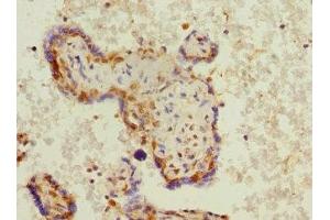 Immunohistochemistry of paraffin-embedded human placenta tissue using ABIN7163046 at dilution of 1:100 (PHF11 antibody  (AA 1-292))