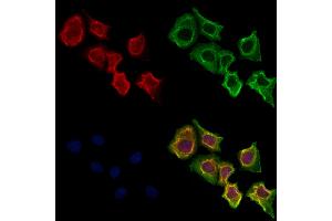 ABIN6264044 and ABIN6273287 staining Hela cells by IF/ICC. (Parvin, beta antibody  (C-Term))