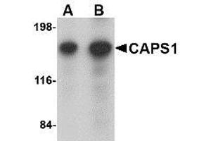 Western blot analysis of CAPS1 in rat brain tissue lysate with AP30179PU-N CAPS1 antibody at (A) 0. (CADPS antibody  (N-Term))