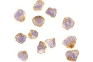 Immunocytochemistry of ASK1 in A431 cells with AP30085PU-N ASK1 antibody at 10 μg/ml. (ASK1 antibody  (C-Term))