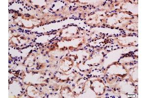 Formalin-fixed and paraffin embedded human kidney labeled with Rabbit Anti-phospho-PRKD3(Ser41) Polyclonal Antibody, Unconjugated  at 1:200 followed by conjugation to the secondary antibody and DAB staining