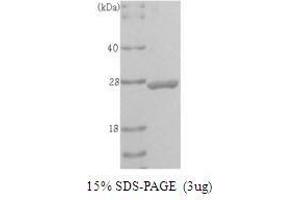Figure annotation denotes ug of protein loaded and % gel used. (UCHL1 Protein (AA 1-223))