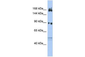 WB Suggested Anti-AFF2  Antibody Titration: 0. (AFF2 antibody  (N-Term))