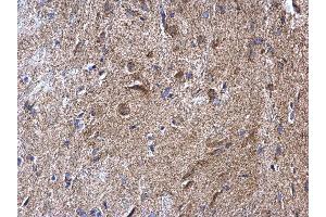 IHC-P Image NDUFV2 antibody detects NDUFV2 protein at mitochondria on mouse fore brain by immunohistochemical analysis. (NDUFV2 antibody  (Center))