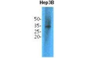 The cell lysates (40 ug) were resolved by SDS-PAGE, transferred to PVDF membrane and probed with anti-human TPMT antibody (1:1,000). (NANS antibody  (AA 1-245))