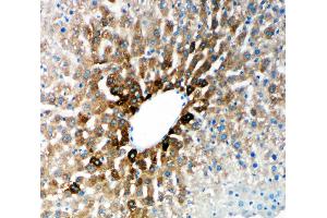 Immunohistochemistry (IHC) image for anti-Cytochrome P450, Family 2, Subfamily E, Polypeptide 1 (CYP2E1) (AA 94-112), (N-Term) antibody (ABIN3044118)