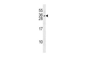 IL28B Antibody (N-term) (ABIN1539309 and ABIN2848533) western blot analysis in SK-BR-3 cell line lysates (35 μg/lane). (IL28B antibody  (N-Term))