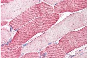 Human Skeletal Muscle (formalin-fixed, paraffin-embedded) stained with ARSB antibody ABIN337028 at 5 ug/ml followed by biotinylated anti-goat IgG secondary antibody ABIN481715, alkaline phosphatase-streptavidin and chromogen. (Arylsulfatase B antibody  (AA 359-372))