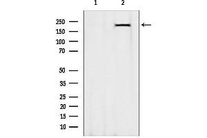 Western blot analysis of lysates from Rat heart, using MYH7-specific Antibody.