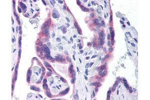 Anti-STT3A antibody IHC of human placenta. (STT3A antibody  (AA 603-702))