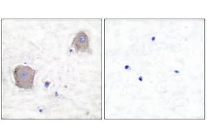 Immunohistochemistry (IHC) image for anti-Glutamate Receptor, Metabotropic 4 (GRM4) (C-Term) antibody (ABIN1848573) (Metabotropic Glutamate Receptor 4 antibody  (C-Term))