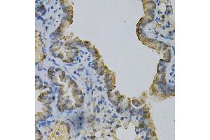 Immunohistochemistry of paraffin-embedded mouse lung using GLUL Antibody (ABIN5973158) at dilution of 1/100 (40x lens). (GLUL antibody)