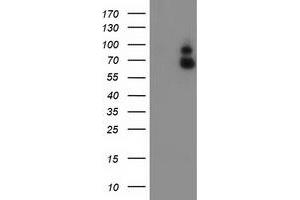 HEK293T cells were transfected with the pCMV6-ENTRY control (Left lane) or pCMV6-ENTRY GBP1 (Right lane) cDNA for 48 hrs and lysed. (GBP1 antibody)