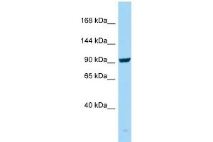 WB Suggested Anti-SEZ6 Antibody Titration: 1. (SEZ6 antibody  (C-Term))