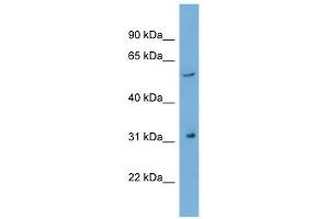 WB Suggested Anti-REM1 Antibody Titration: 0. (REM1 antibody  (N-Term))