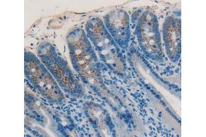 Used in DAB staining on fromalin fixed paraffin- embedded Kidney tissue (IGFBP4 antibody  (AA 22-254))
