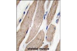 Forlin-fixed and paraffin-embedded hun skeletal muscle tissue reacted with P2K5 Antibody  f , which was peroxidase-conjugated to the secondary antibody, followed by DAB staining. (MAP2K5 antibody  (AA 127-156))