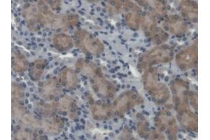 IHC-P analysis of Mouse Kidney Tissue, with DAB staining. (Calpain 5 antibody  (AA 26-343))
