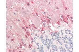 Human Brain, Cerebellum: Formalin-Fixed, Paraffin-Embedded (FFPE). (DFNA5 antibody  (Biotin))