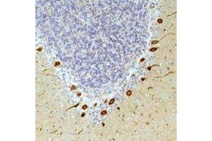 Immunohistochemical analysis of Ghrelin Receptor staining in human brain,human skin formalin fixed paraffin embedded tissue section. (GHSR antibody)