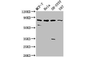 Western Blot Positive WB detected in: MCF-7 whole cell lysate, Hela whole cell lysate, SH-SY5Y whole cell lysate, U87 whole cell lysate All lanes: IL1RAPL1 antibody at 5.