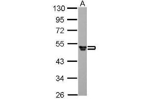 WB Image Fibrinogen gamma antibody detects FGG protein by Western blot analysis. (FGG antibody)