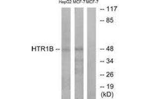 Western Blotting (WB) image for anti-Serotonin Receptor 1B (HTR1B) (AA 261-310) antibody (ABIN2890744) (5HT1B Receptor antibody  (AA 261-310))