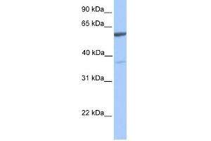 WB Suggested Anti-NAB2 Antibody Titration:  0.