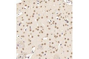 Immunohistochemistry (Paraffin-embedded Sections) (IHC (p)) image for anti-Ubiquitin Protein Ligase E3A (ube3a) antibody (ABIN7076105)