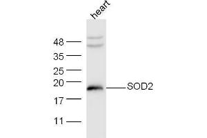 Mouase heart lysates probed with Anti-SOD2 Polyclonal Antibody at 1:5000 90min in 37˚C. (SOD2 antibody  (AA 41-78))
