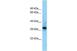 WB Suggested Anti-CD86 Antibody Titration: 1. (CD86 antibody  (C-Term))