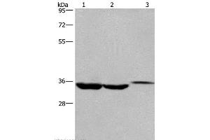 Western Blot analysis of Lovo cell,Human liver cancer tissue and Mouse kidney tissue using ING2 Polyclonal Antibody at dilution of 1:425 (ING2 antibody)