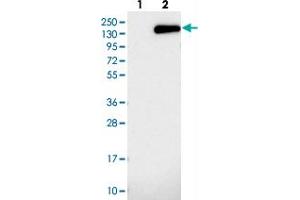 Western blot analysis of Lane 1: Negative control (vector only transfected HEK293T lysate), Lane 2: Over-expression Lysate (Co-expressed with a C-terminal myc-DDK tag (~3. (NUP155 antibody)