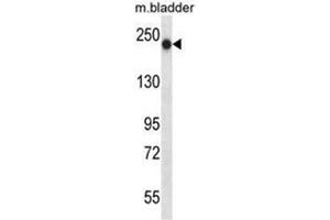 BRIP1 Antibody (N-term) western blot analysis in mouse bladder tissue lysates (35µg/lane). (BRIP1 antibody  (N-Term))