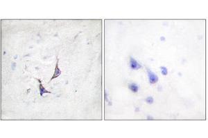 Immunohistochemistry (IHC) image for anti-Syndecan 4 (SDC4) (Ser179) antibody (ABIN1848043) (SDC4 antibody  (Ser179))