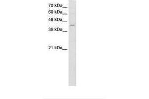 Image no. 1 for anti-Fatty Acid Desaturase 1 (FADS1) (AA 428-477) antibody (ABIN204996) (FADS1 antibody  (AA 428-477))