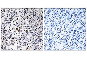 Immunohistochemistry analysis of paraffin-embedded human lymph node tissue using CD302 antibody. (DCL1 antibody  (Internal Region))