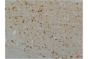 Immunohistochemistry (IHC) analysis of paraffin-embedded Rat Brain Tissue using Cav1. (CACNA1D antibody)