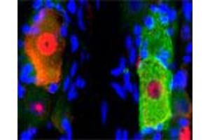 IF on rat trigeminal using Mouse monoclonal antibody to rat p75NTR (ABIN350707) at a concentration of 10 µg/ml, Rabbit antibody to internal part of cFos (c-fos): whole serum (ABIN350207) at 1 : 500 dilution and DAPI counterstained. (NGFR antibody)