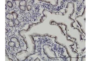 Image no. 2 for anti-Apoptosis Inhibitor 5 (API5) (AA 400-504) antibody (ABIN466131) (Apoptosis Inhibitor 5 antibody  (AA 400-504))